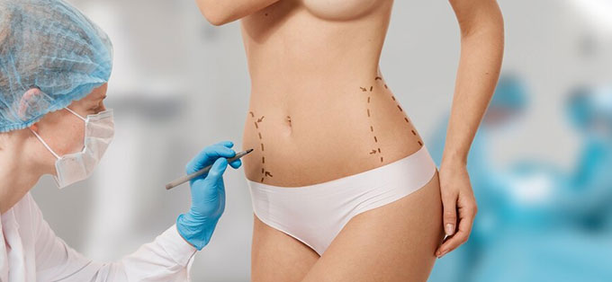 Lipoaspiration ou Liposuccion en Tunisie - Health and Care